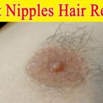 How To Remove Hair From Breast Nipples